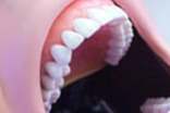 牙齦腫痛怎么辦